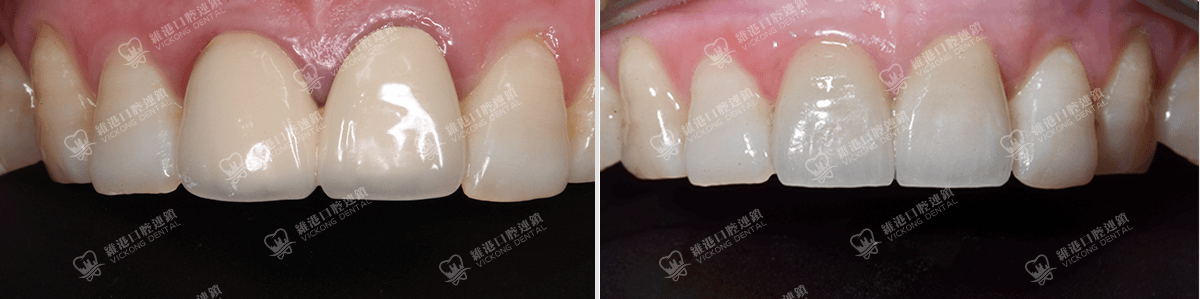 ShenzhenDental&VICKONGDENTAL