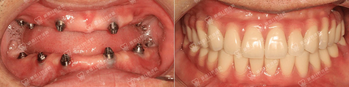 ShenzhenDental&VICKONGDENTAL